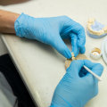 From Gaps To Grins: Dental Implants In San Antonio