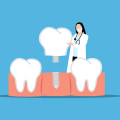 Understanding Dental Implant Surgery in North Little Rock