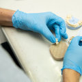 A Lasting Solution: Dental Implants In Ashburn, VA