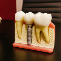 Your Child's Dental Health Journey: Children's Dentist And Teeth Implants In Loudoun County