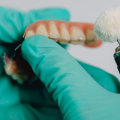 Smile Confidently: Exploring Teeth Implants In Rockville, MD
