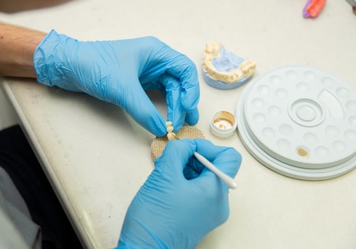 Complete Your Smile: Exploring Teeth Implants In Edmonds