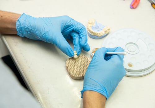A Lasting Solution: Dental Implants In Ashburn, VA