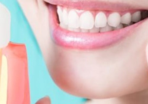Smile With Confidence: Exploring Teeth Implants In Gainesville, VA