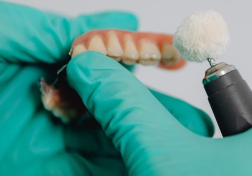 Smile Confidently: Exploring Teeth Implants In Rockville, MD