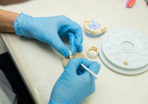 The Road To A Beautiful Smile: All About Teeth Implants In Manassas Park
