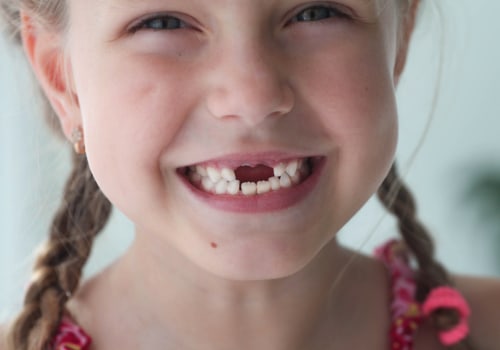 Helping Your Child Smile Again: Teeth Implants For Kids In Summerville, SC