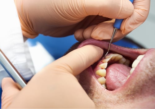 Are Dental Implants Safe for Your Heart?